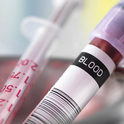 westbury-family-medical-practice-blackrock-cork-blood-test-services